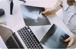 Radiografias sobre a mesa ao lado de um notebook, examinadas por duas pessoas