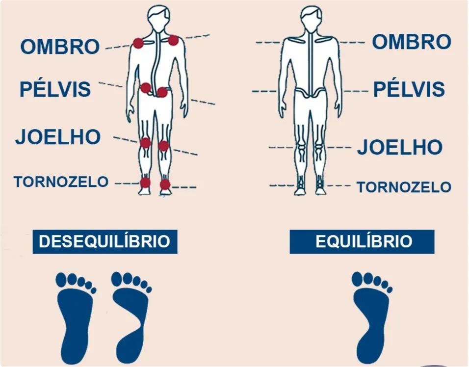 Comparação entre desequilíbrio e equilíbrio postural nos níveis de ombro, pelve, joelho e tornozelo