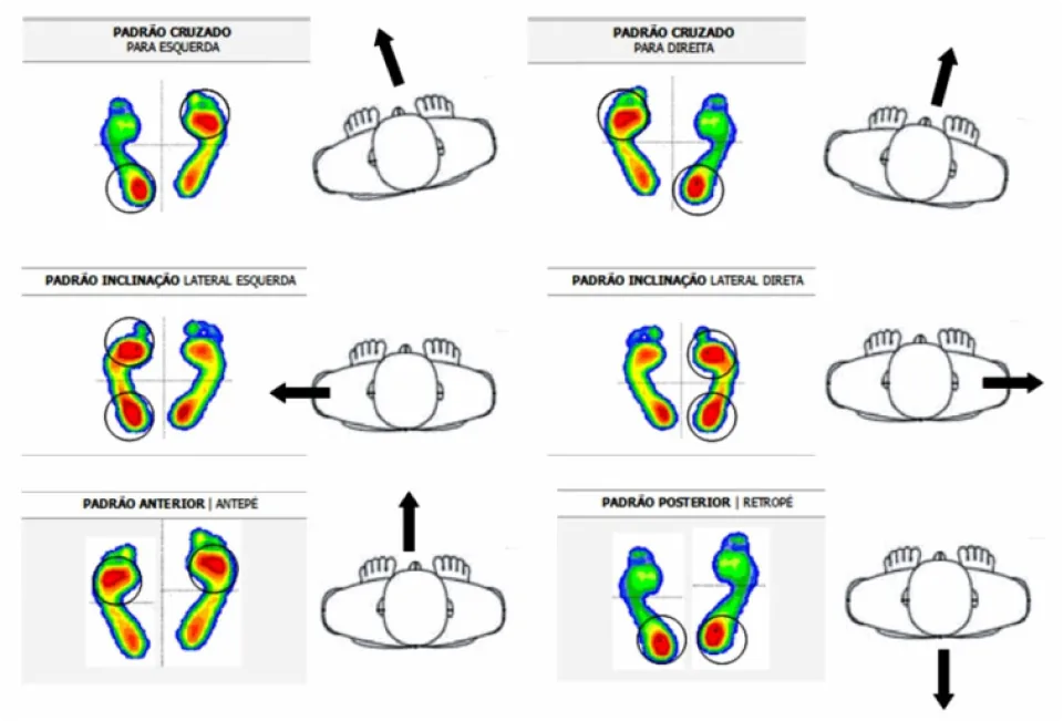 Padrões de pressão plantar: cruzado, inclinação lateral, anterior e posterior