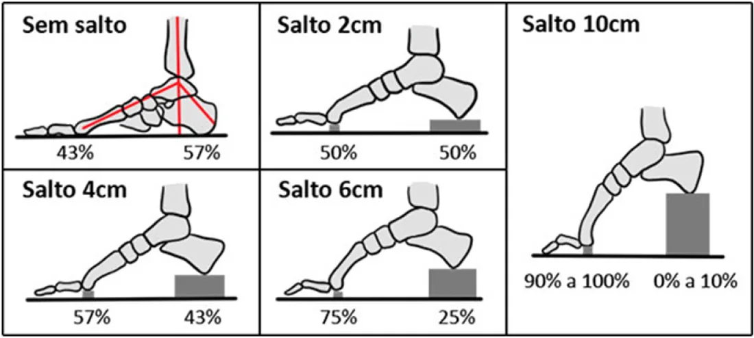 Distribuição do peso no pé conforme a altura do salto: sem salto 43% no calcanhar e 57% na frente; com salto de 10 cm, 90% a 100% na frente