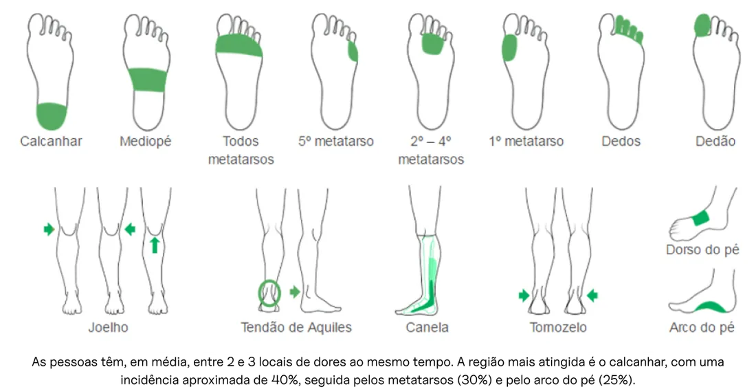 Mapa das regiões onde a dor costuma aparecer no pé e na perna: calcanhar, mediopé, metatarsos, dedos, joelho, tendão de Aquiles, canela, tornozelo e arco plantar