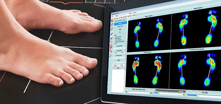 Pés sobre a plataforma de exame, ao lado da tela com os mapas coloridos de pressão plantar