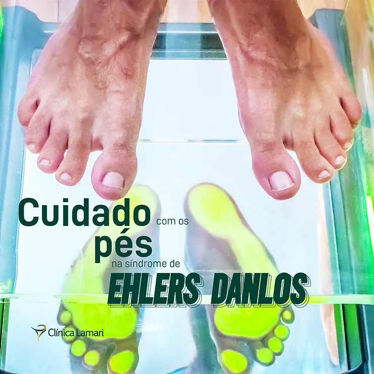 Arte “Cuidado com os pés na Síndrome de Ehlers-Danlos”, com pés apoiados sobre uma placa de exame