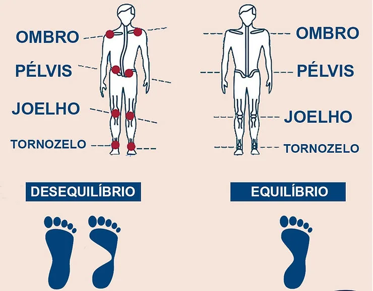 Comparação entre desequilíbrio e equilíbrio postural nos níveis de ombro, pelve, joelho e tornozelo